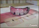 Graphic on Mouth Guard 001
